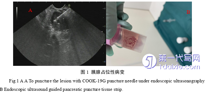 医学论文参考